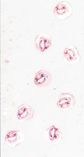 Media type: image; Special Collections 3992   shows specimen_part histological serial section;